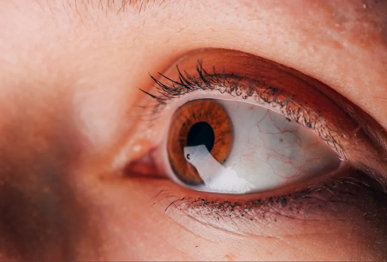 Kako redoviti pregledi očiju mogu spriječiti ozbiljne bolesti